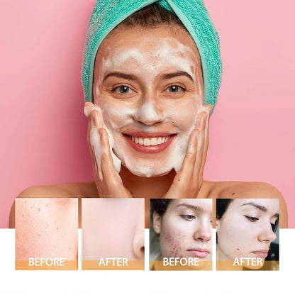 2 Pcs Turmeric Glow Wash Face Wash with Brush, Deep Cleansing Facial Skin Turmeric Foaming Face Wash. - myshop