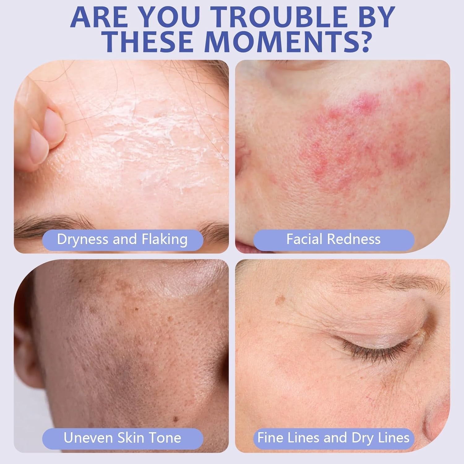 The Dewy Skin Cream Face Moisturizer Skin Care Face Cream Boost Water Gel Lightweight Oil - Free - Improve Skins Hydration 1.7 Fl Oz - myshop